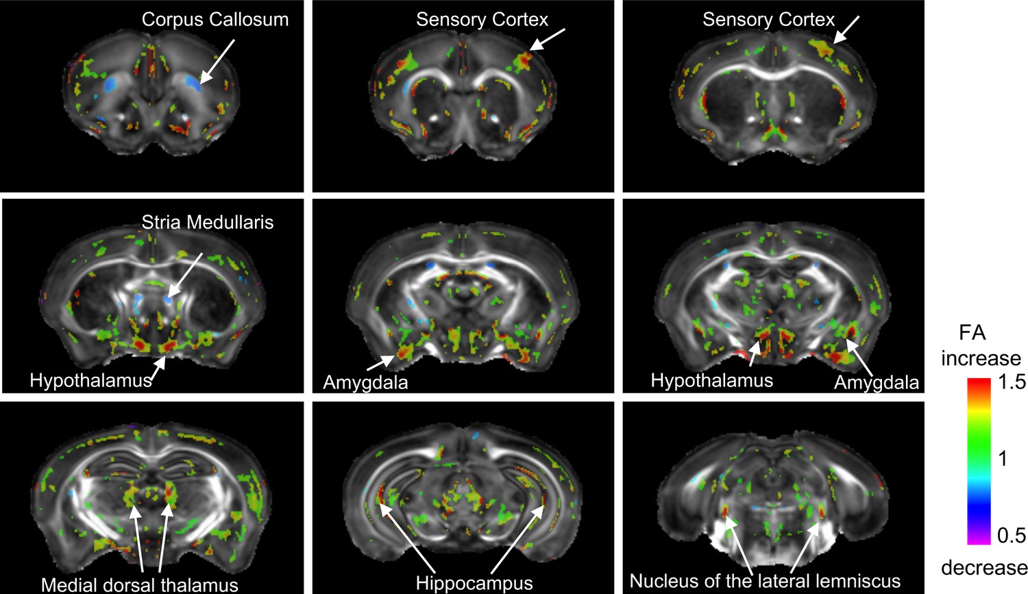 Figures And Data In Early Life Stress Causes Sex Specific Changes In