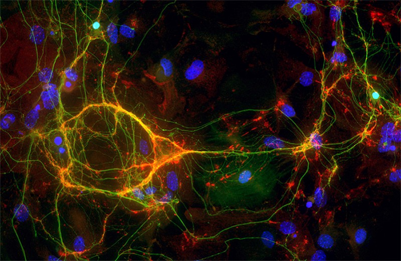 Tracing back nerve cell communication | eLife Science Digests | eLife