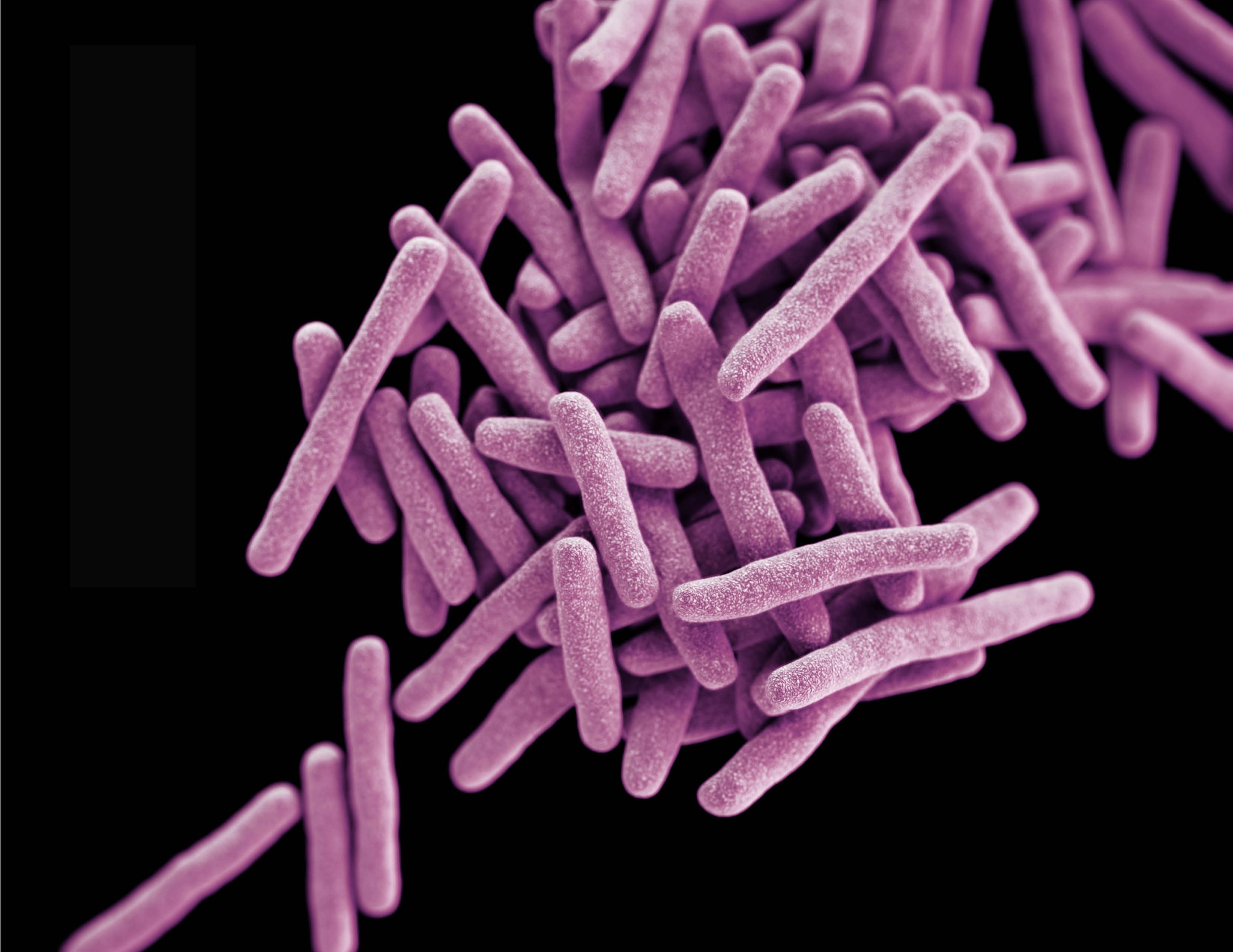 Tuberculosis bacteria thrive on a nitrogen-source buffet | eLife