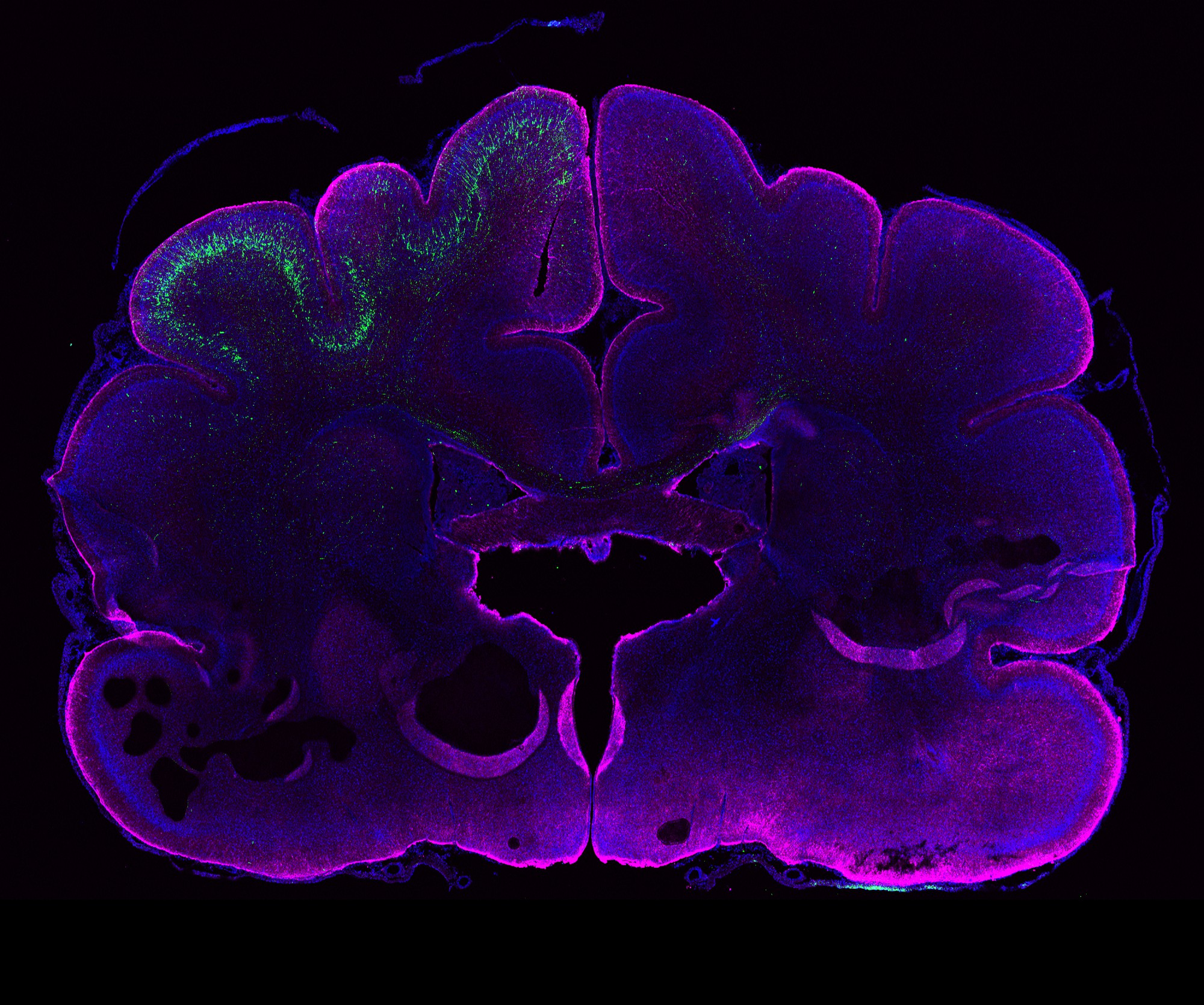 Large brain. Неокортекс Нейроны. Gigabrain. Cerebral Cortex of Smokers. Big Brain.