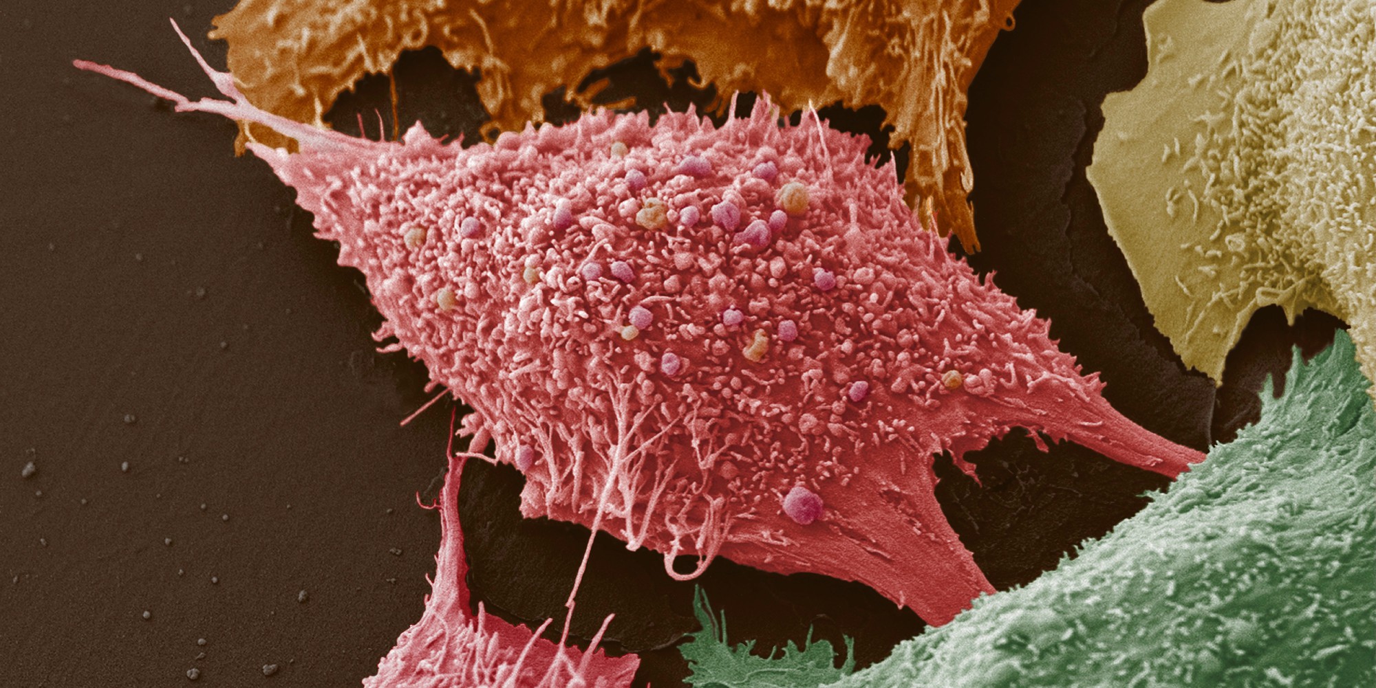 what-do-cancer-cells-eat-elife-science-digests-elife