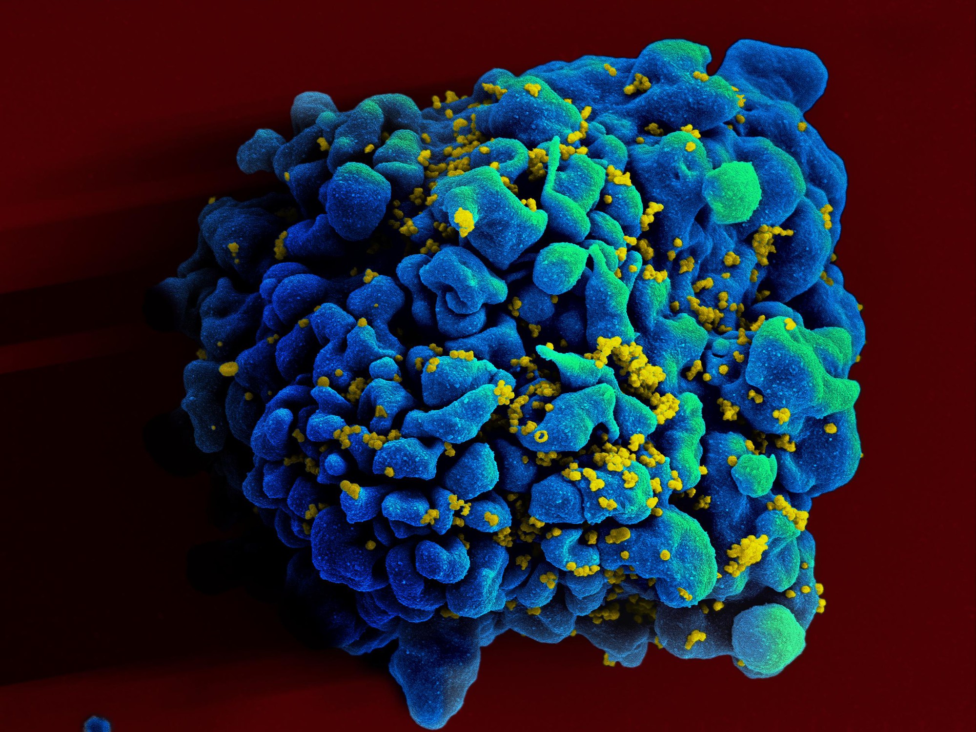 Where Does HIV Hide In The Body ELife Science Digests ELife