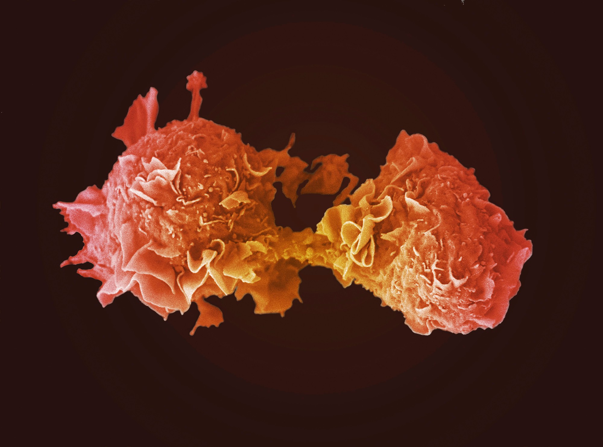 Which proteins affect resistance to anti-cancer drugs? | eLife Science