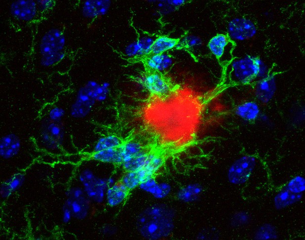 Lazy microglia | eLife Science Digests | eLife