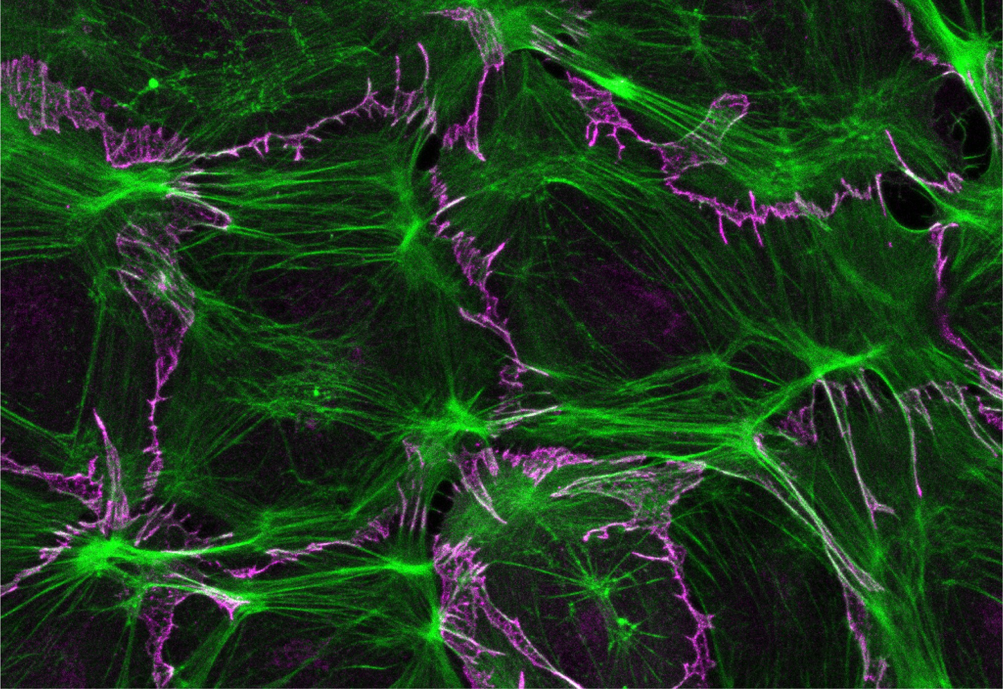 How lymphatic vessels stay intact eLife Science Digests eLife