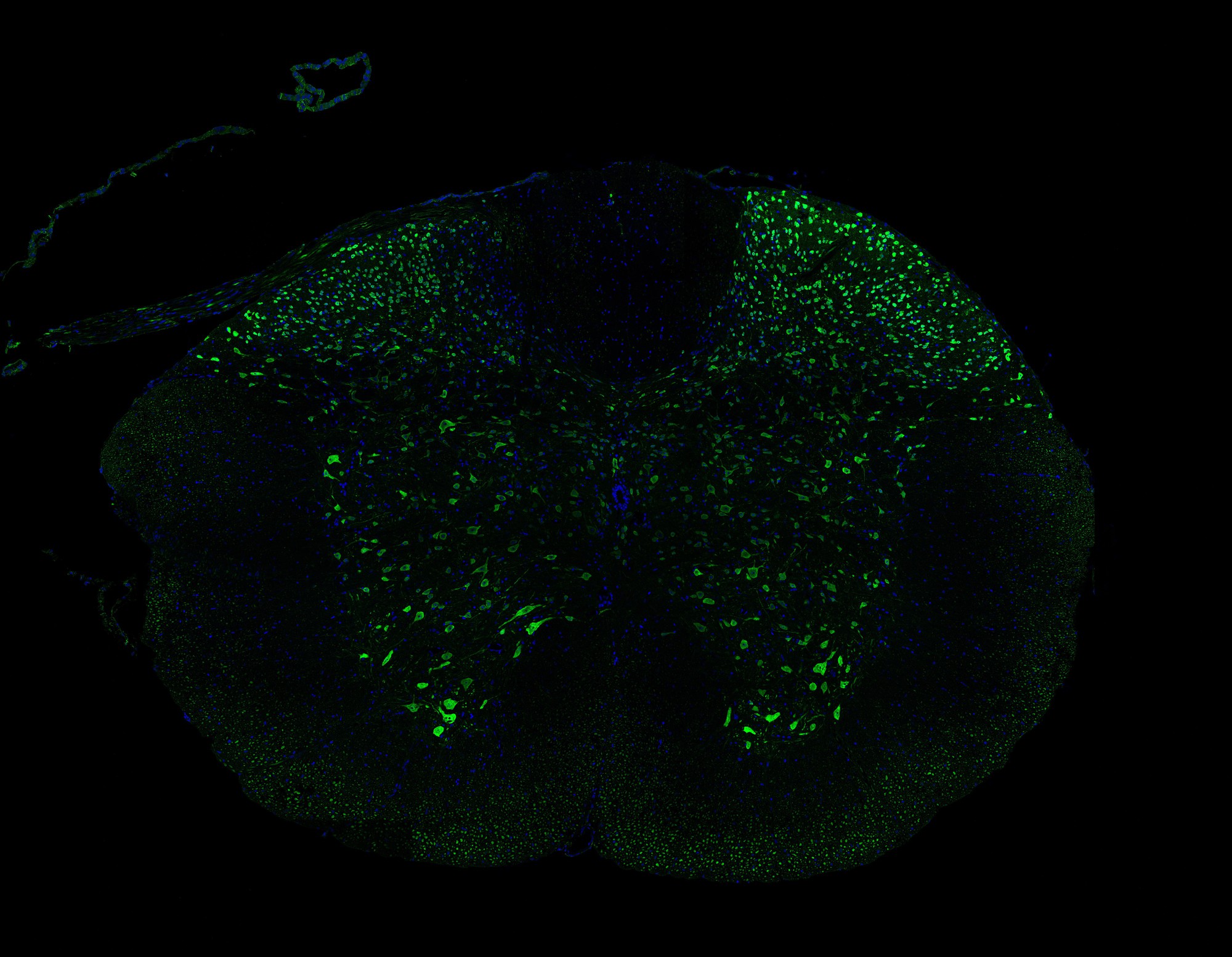 Boosting Mitochondria Against Multiple Sclerosis | ELife Science ...