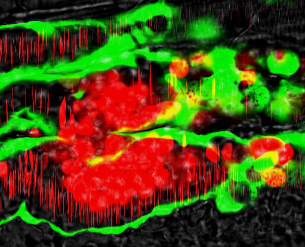 a-new-model-for-venous-thrombosis-elife-science-digests-elife