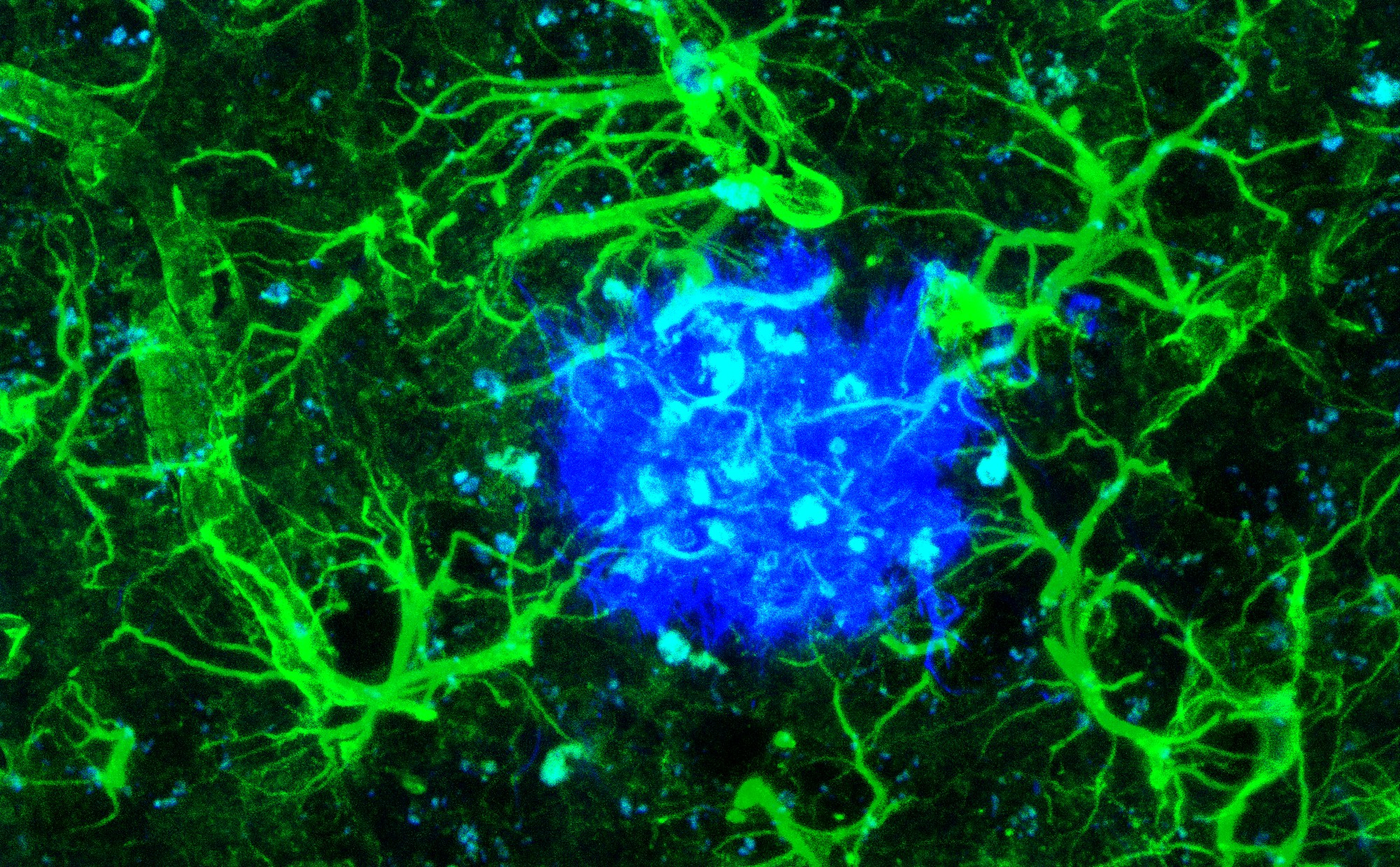 Astrocyte Signal Loss In Alzheimer’s Disease | ELife Science Digests ...