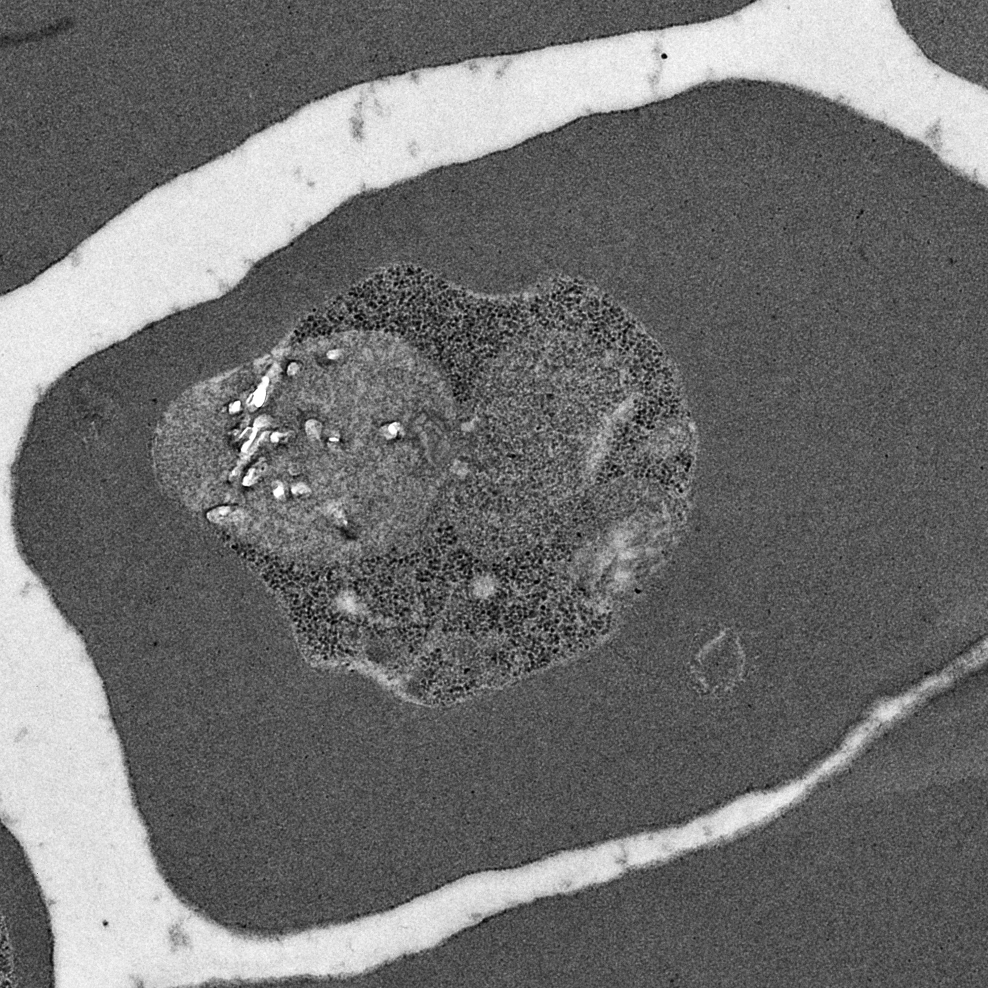 Halting Haemoglobin Digestion ELife Science Digests ELife   Default 