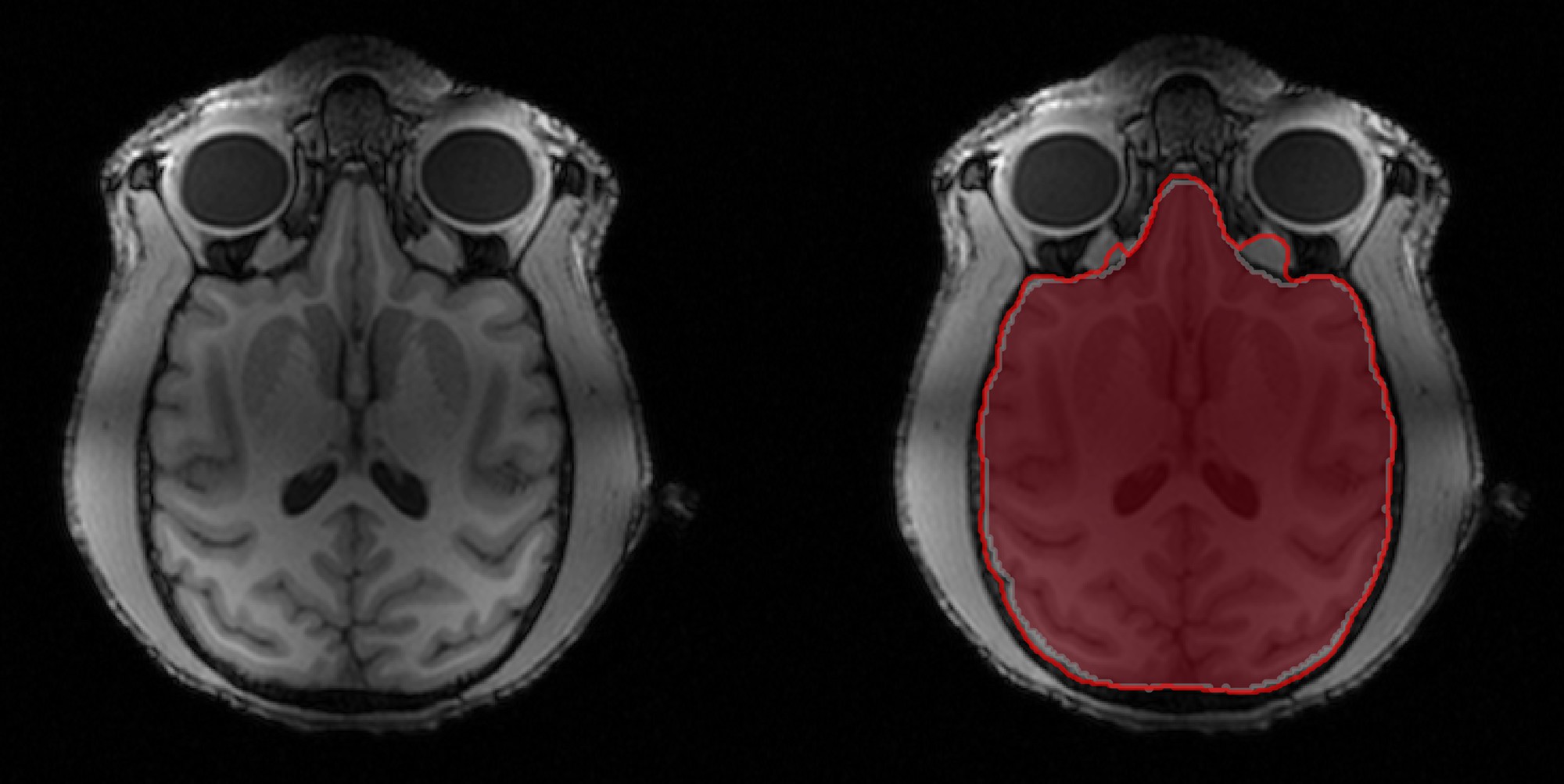 extracting-brain-tissue-with-ben-elife-science-digests-elife