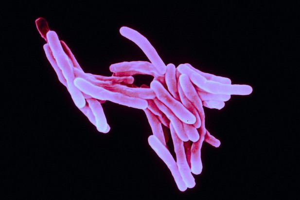 Scanning electron microscope image of mycobacterium tuberculosis