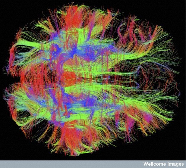 Nerve fibres in a brain