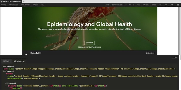 Epidemiology and Global Health section header shown above Mustache template code