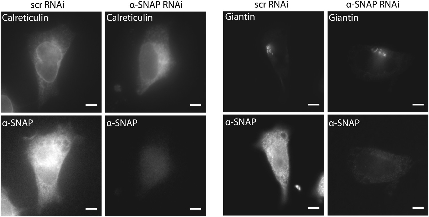 Figures and data in An essential and NSF independent role for α-SNAP in ...