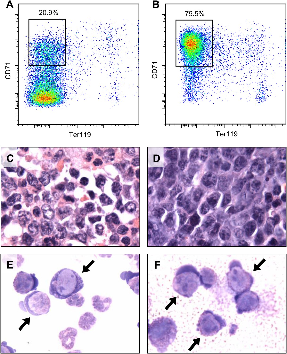 Figures and data in MYBL2 is a sub-haploinsufficient tumor suppressor ...