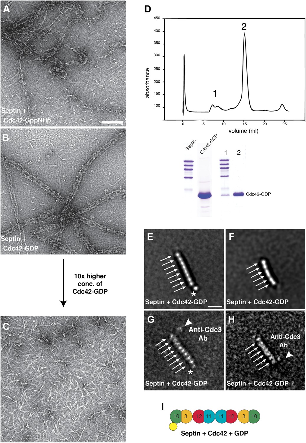 Mutant septins evade exclusion by quality control if assembled into