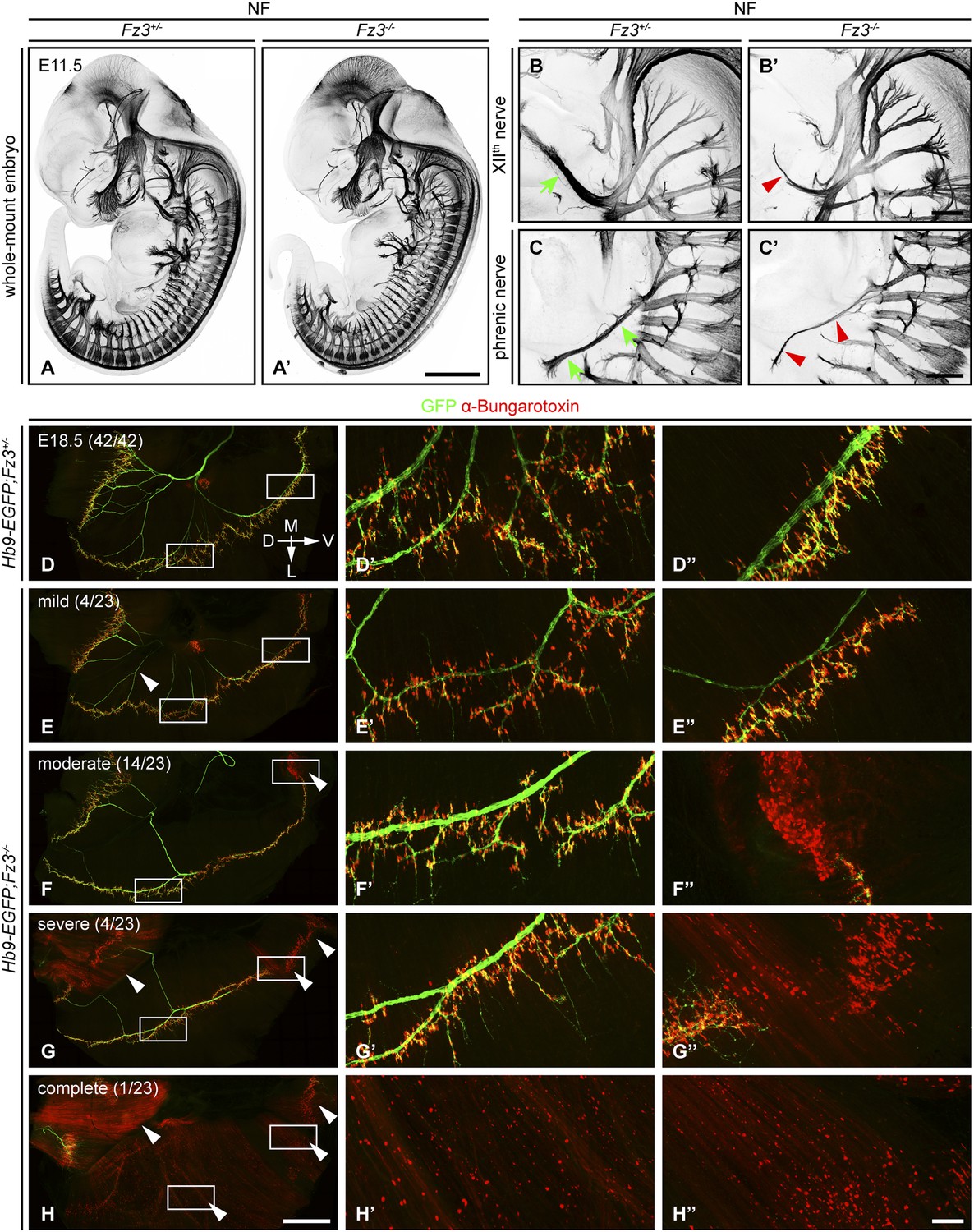 Frizzled3 controls axonal development in distinct