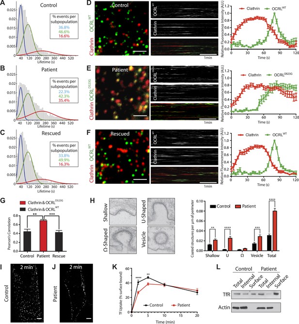 A role of OCRL in clathrin-coated pit dynamics and uncoating revealed ...