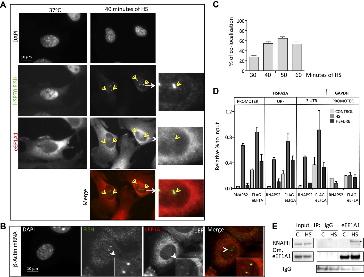 The Translation Elongation Factor EEF1A1 Couples Transcription To ...