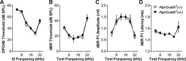 Figures and data in Neurotrophin-3 regulates ribbon synapse density in ...