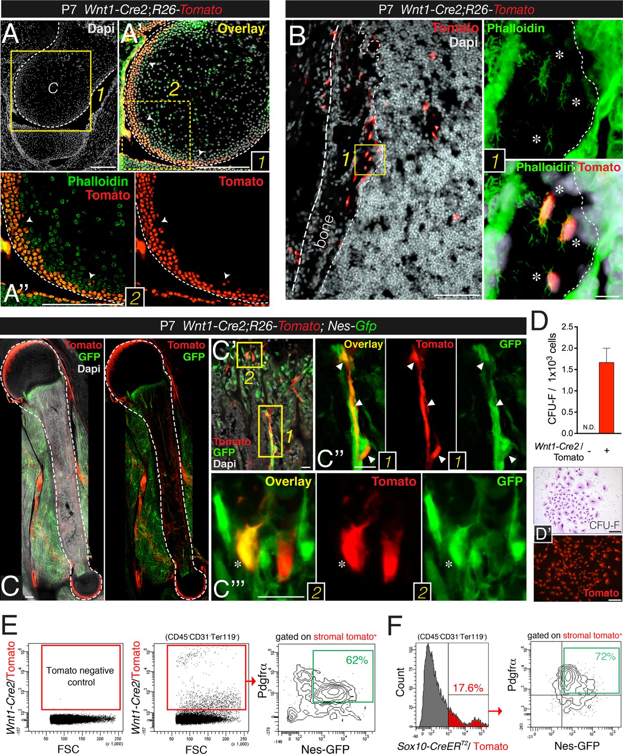The Neural Crest Is A Source Of Mesenchymal Stem Cells With Specialized the-neural-crest-is-a-source-of-mesenchymal-stem-cells-with-specialized