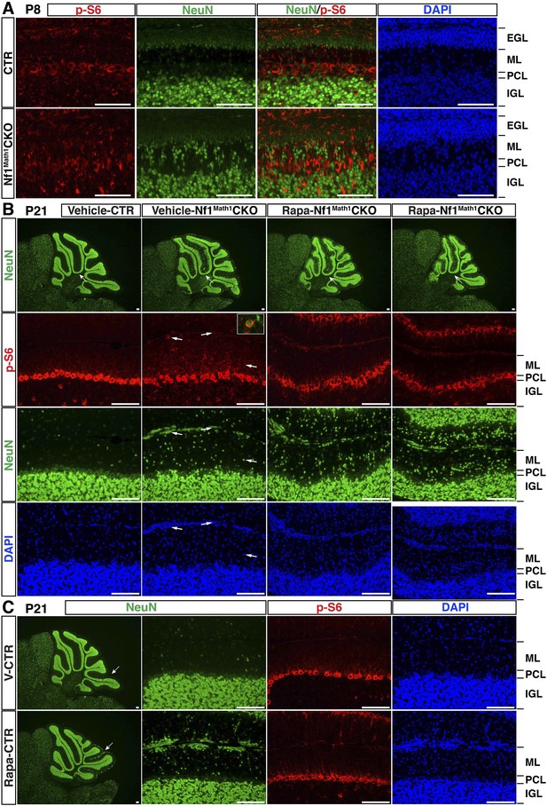 Figures And Data In Transient Inhibition Of The ERK Pathway Prevents