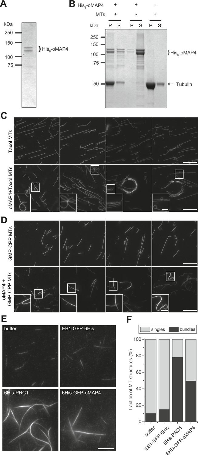 Effects of three microtubule-associated proteins (MAP2, MAP4, and Tau) on  microtubules' physical properties and neurite morphology