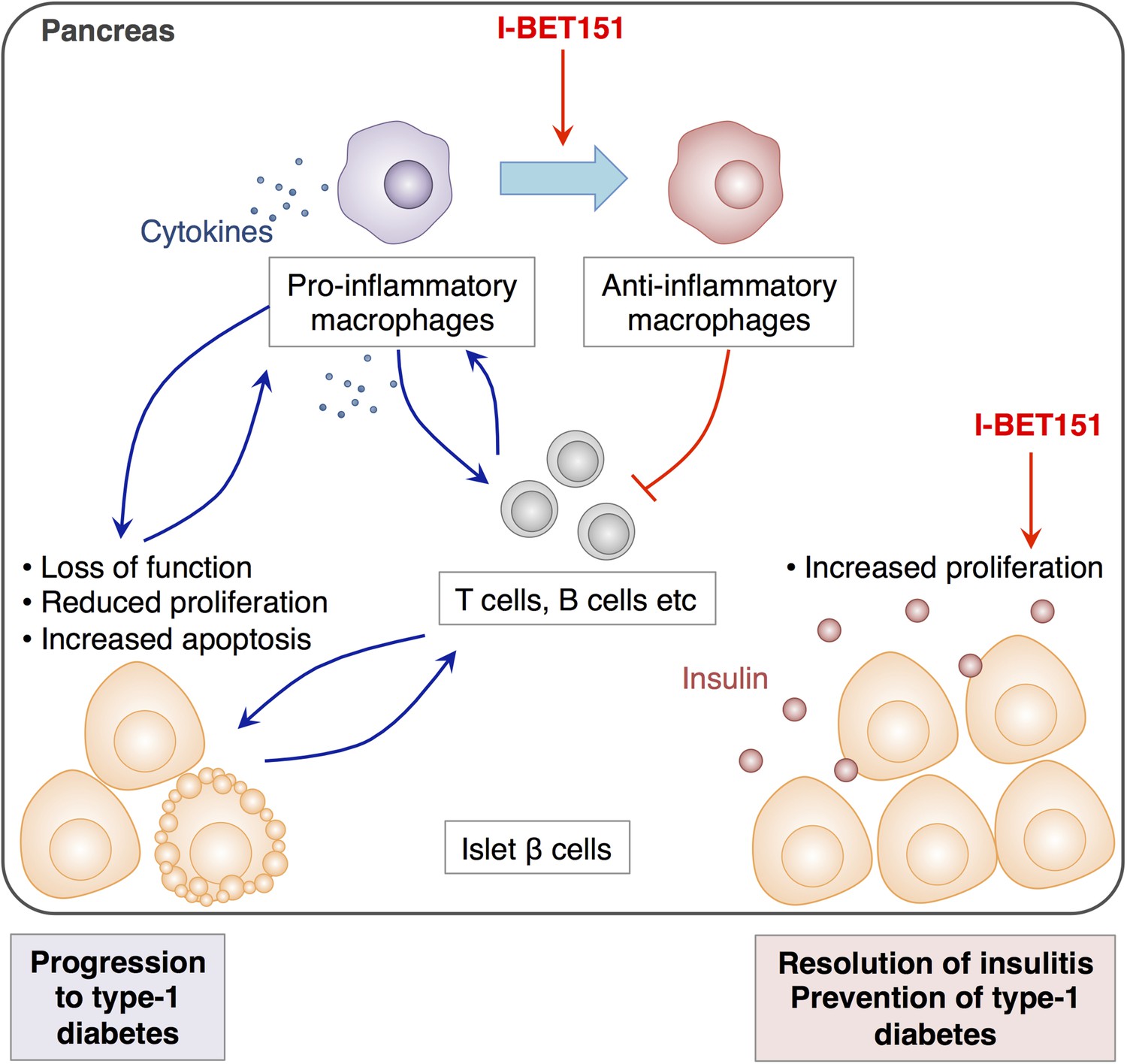 Autoimmunity Treating type1 diabetes with an drug eLife