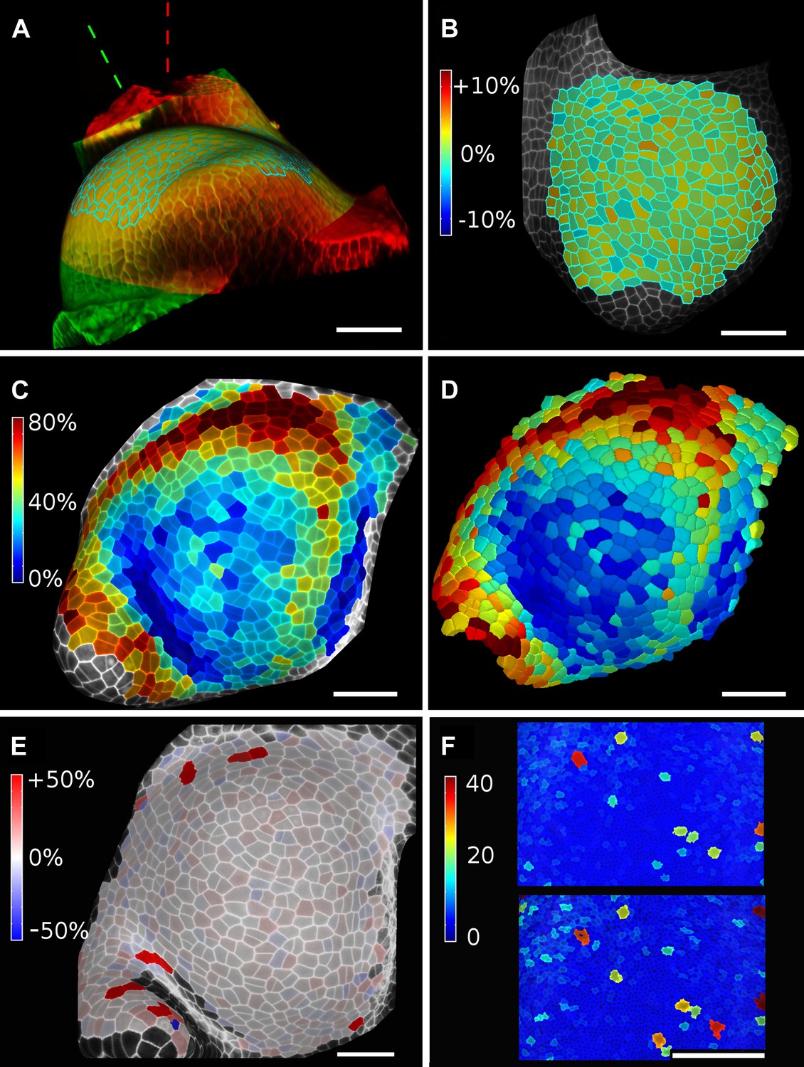 MorphoGraphX: A platform for quantifying morphogenesis in 4D
