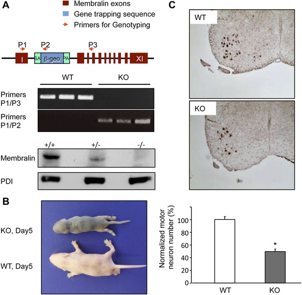 Figures and data in The critical role of membralin in postnatal motor ...