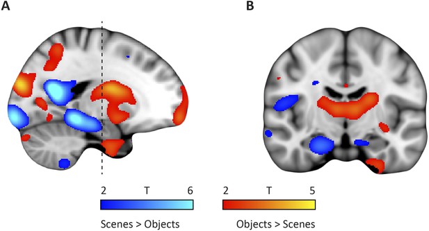 Figures and data in Functional topography of the human entorhinal ...