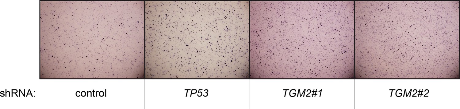 Figures and data in Transglutaminase 2 contributes to a TP53-induced ...