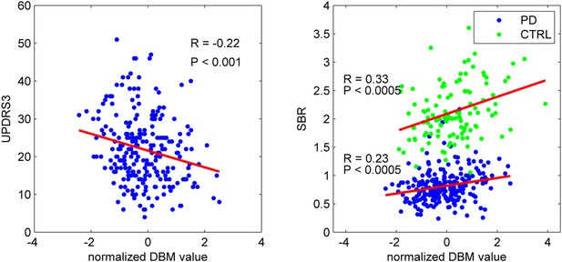 Network structure of brain atrophy in de novo Parkinson's disease | eLife