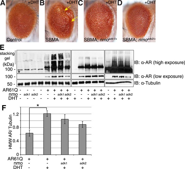 Nemo-like kinase is a novel regulator of spinal and bulbar muscular ...