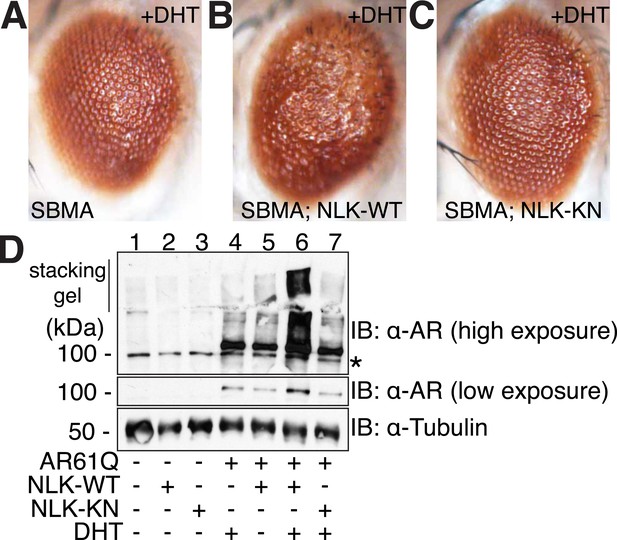 Nemo-like kinase is a novel regulator of spinal and bulbar muscular ...