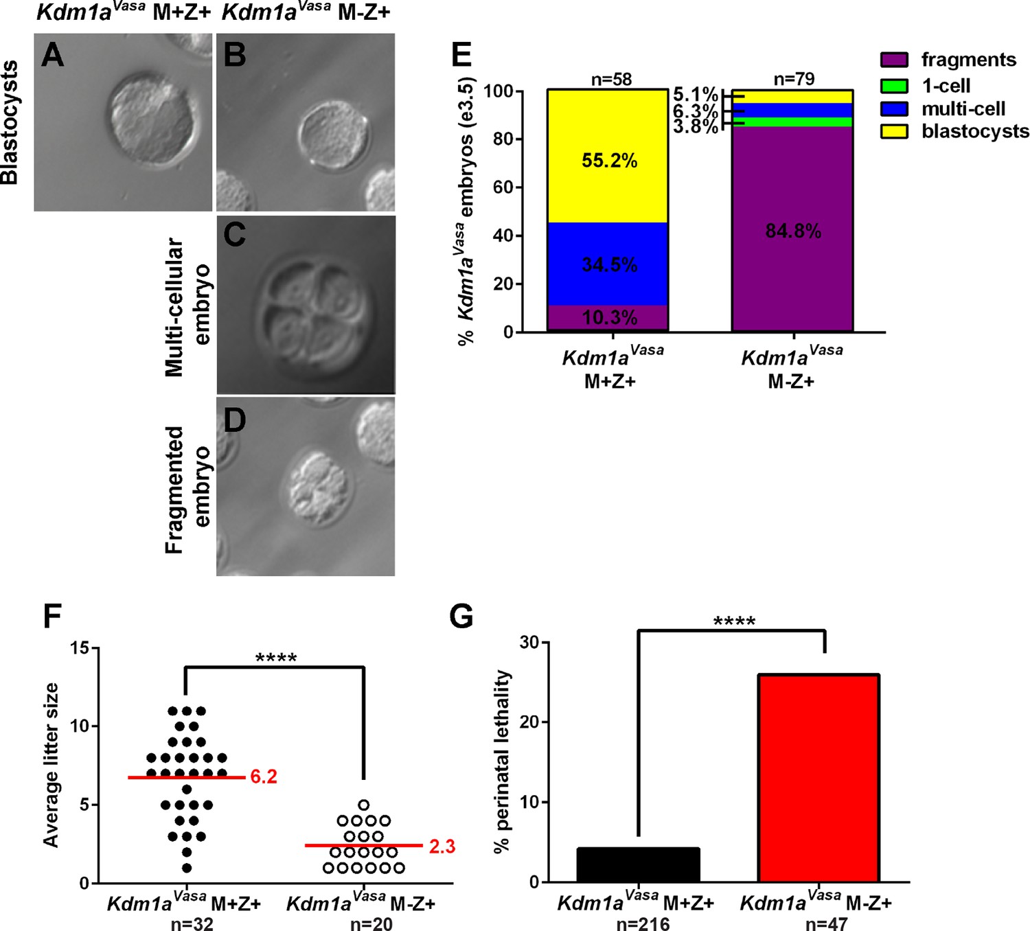 レア！DETAMINATIONS FULLOFDETERMINATION JCI Insight - Fbxo2 mediates clearance of damaged lysosomes