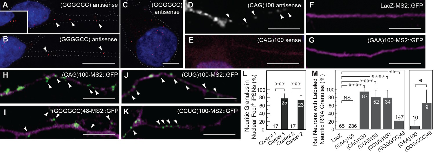 GGGGCC microsatellite RNA is neuritically localized, induces