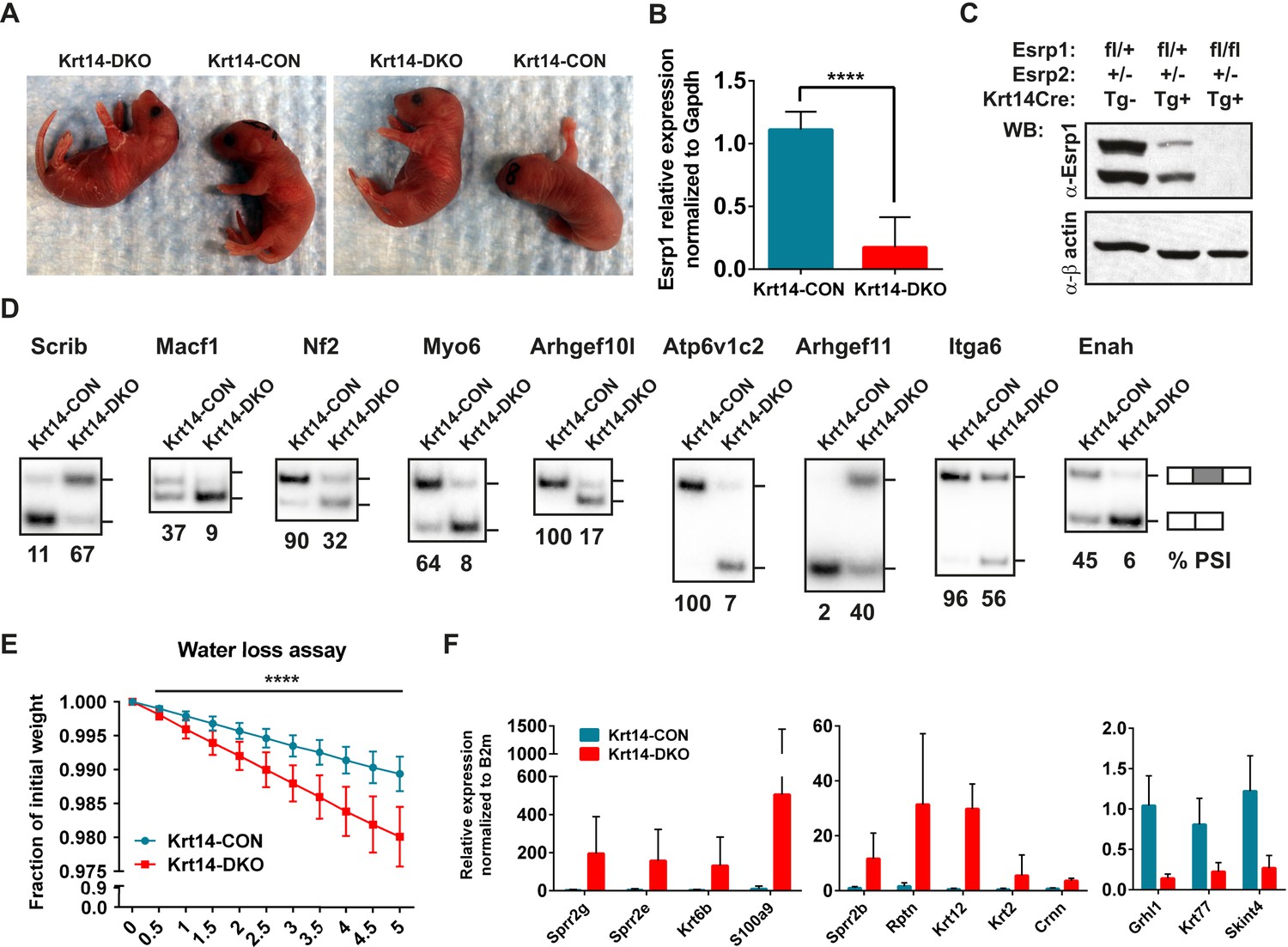 The splicing regulators Esrp1 and Esrp2 direct an epithelial