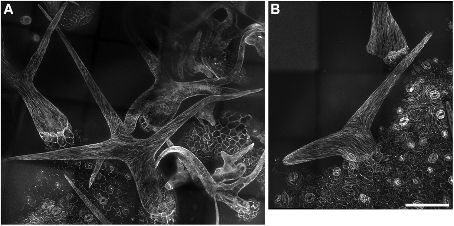 Figures And Data In Orchestration Of Microtubules And The Actin ...