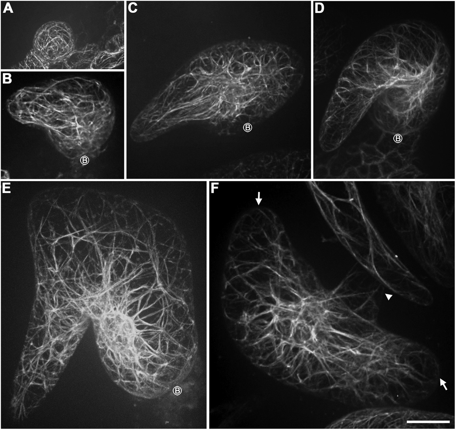 Figures And Data In Orchestration Of Microtubules And The Actin ...