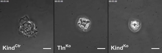 Kindlin-2 cooperates with talin to activate integrins and induces cell ...