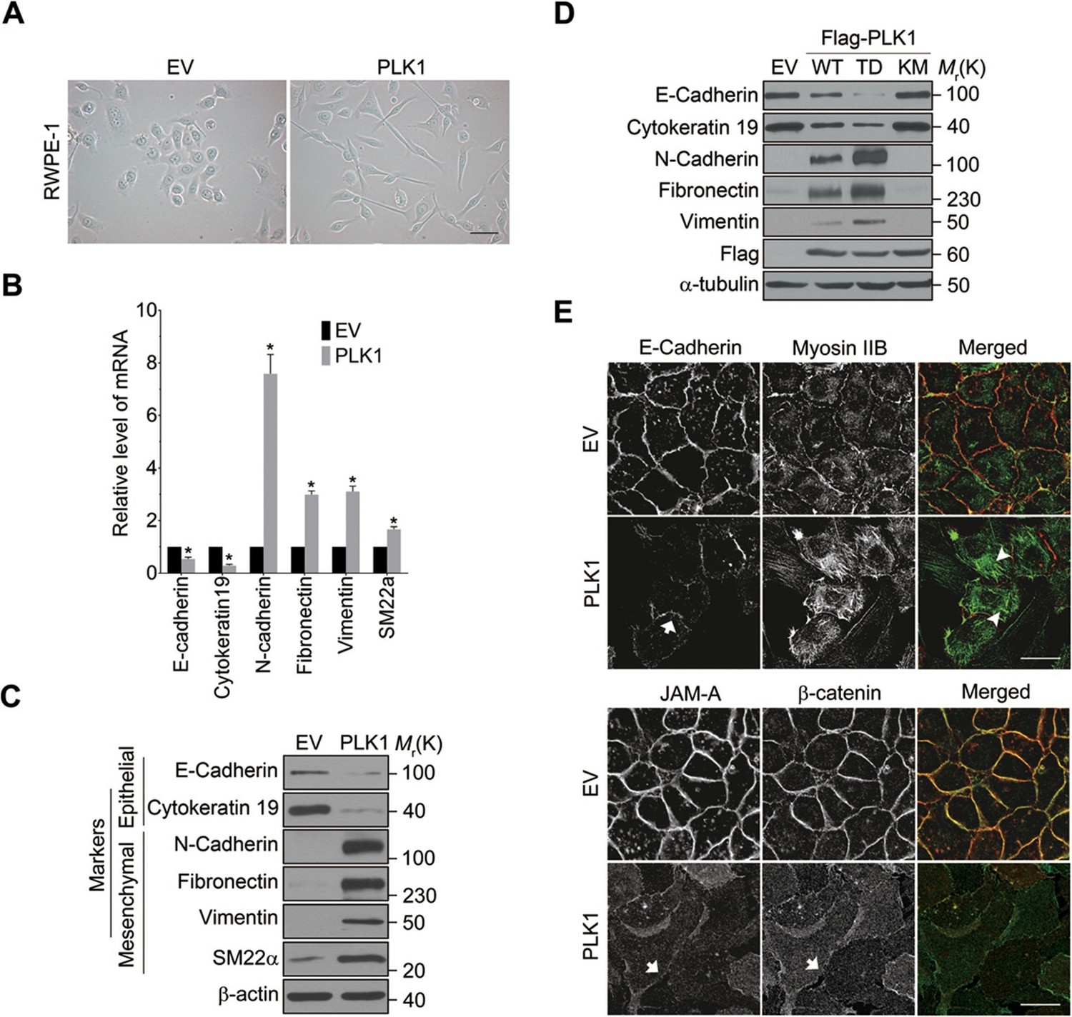 【超歓迎】 Polo-like kinase 1 induces epithelial-to-mesenchymal テレビ