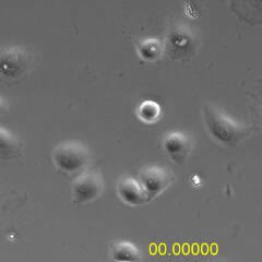 Polo-like kinase 1 induces epithelial-to-mesenchymal Polo-like kinase 1 induces epithelial-to-mesenchymal