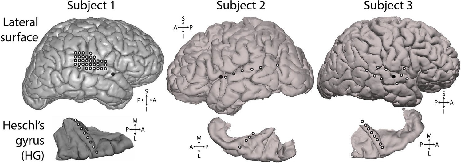 Figures and data in Neural signatures of perceptual inference | eLife