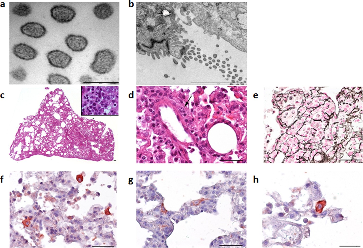 Figures And Data In Evidence Of Human Infection By A New Mammarenavirus ...