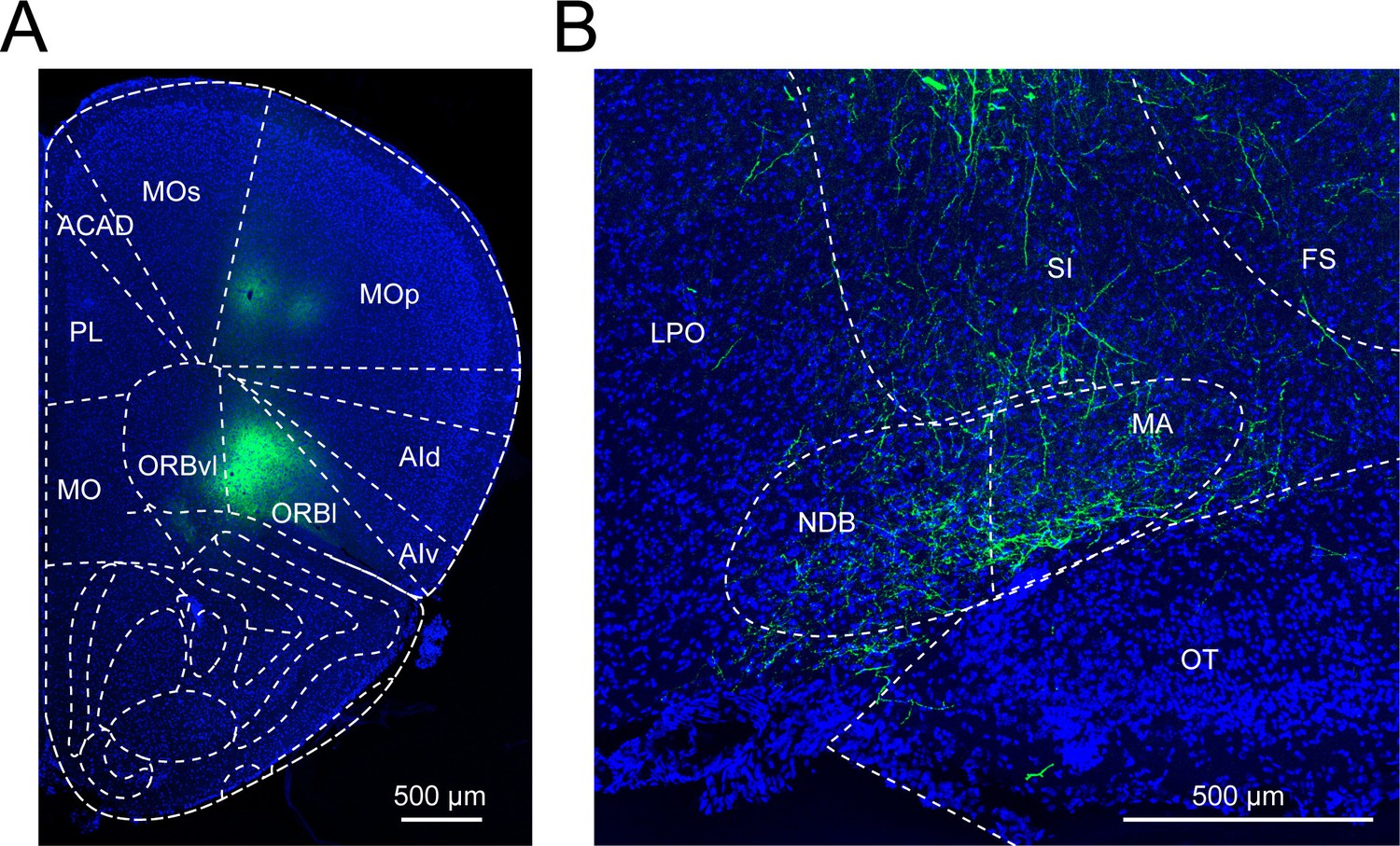 Basal forebrain subcortical projections