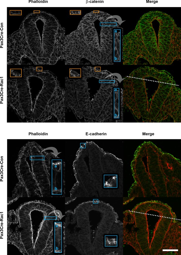 Figures and data in Regulation of cell protrusions by small GTPases ...