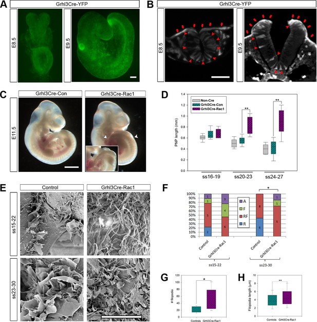 Figures and data in Regulation of cell protrusions by small GTPases ...