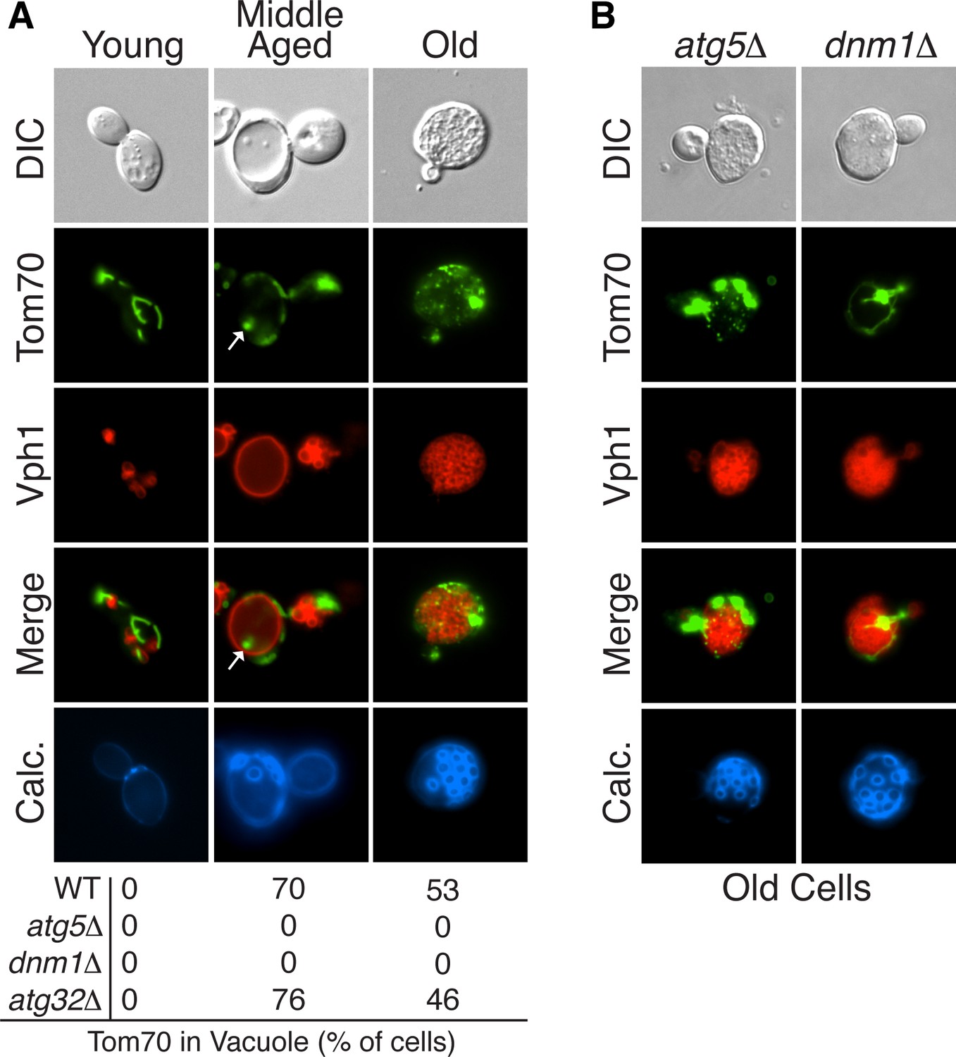 Selective sorting and destruction of mitochondrial membrane