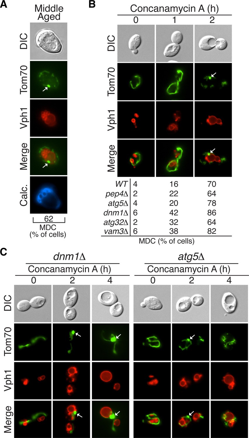 Selective sorting and destruction of mitochondrial membrane